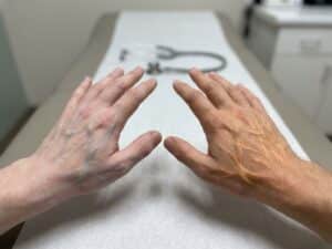 Twee handen met gloeiende zenuwbanen in blauw en oranje tegen medische achtergrond, stethoscoop zichtbaar